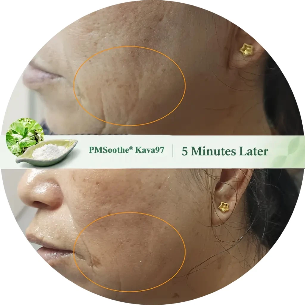 PMSoothe® Kava97 before and after showing visible reduction in expression lines after 5 minutes