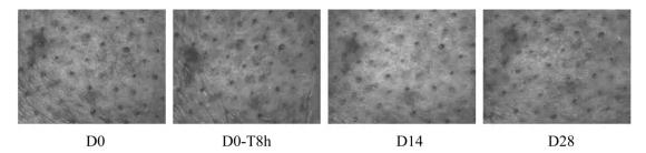 Skin Roughness Improvement Case Study | Plamed