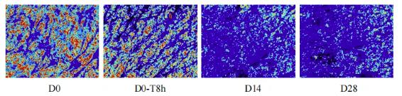 Stratum Corneum Desquamation Case Study | Plamed